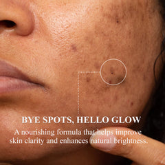 Dark Spot Cream | Tranexamic Acid, Niacinamide & Kojic Dipalmitate Cream | 50g