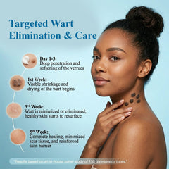 Vijeta Herbal Wart Cream | Salicylic Acid & Tea Tree Skin Care Cream | 50g