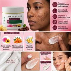 Dark Spot Cream | Tranexamic Acid, Niacinamide & Kojic Dipalmitate Cream | 50g